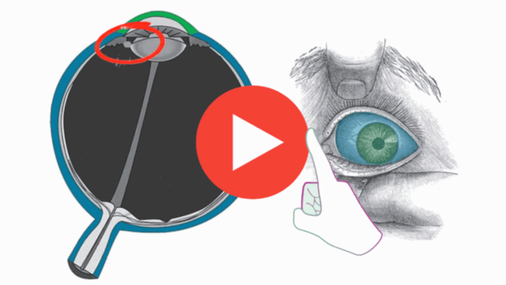 Watch This Short Video